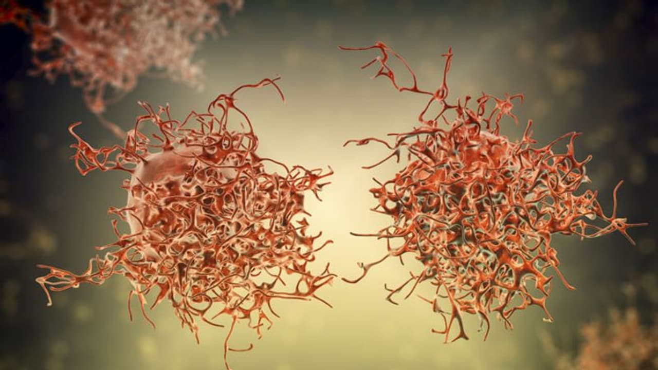 കാൻസർ സാധ്യത കുറയ്ക്കുന്നതിന് ജീവിതശെെലിയിൽ ശ്രദ്ധിക്കേണ്ട 5 കാര്യങ്ങൾ 