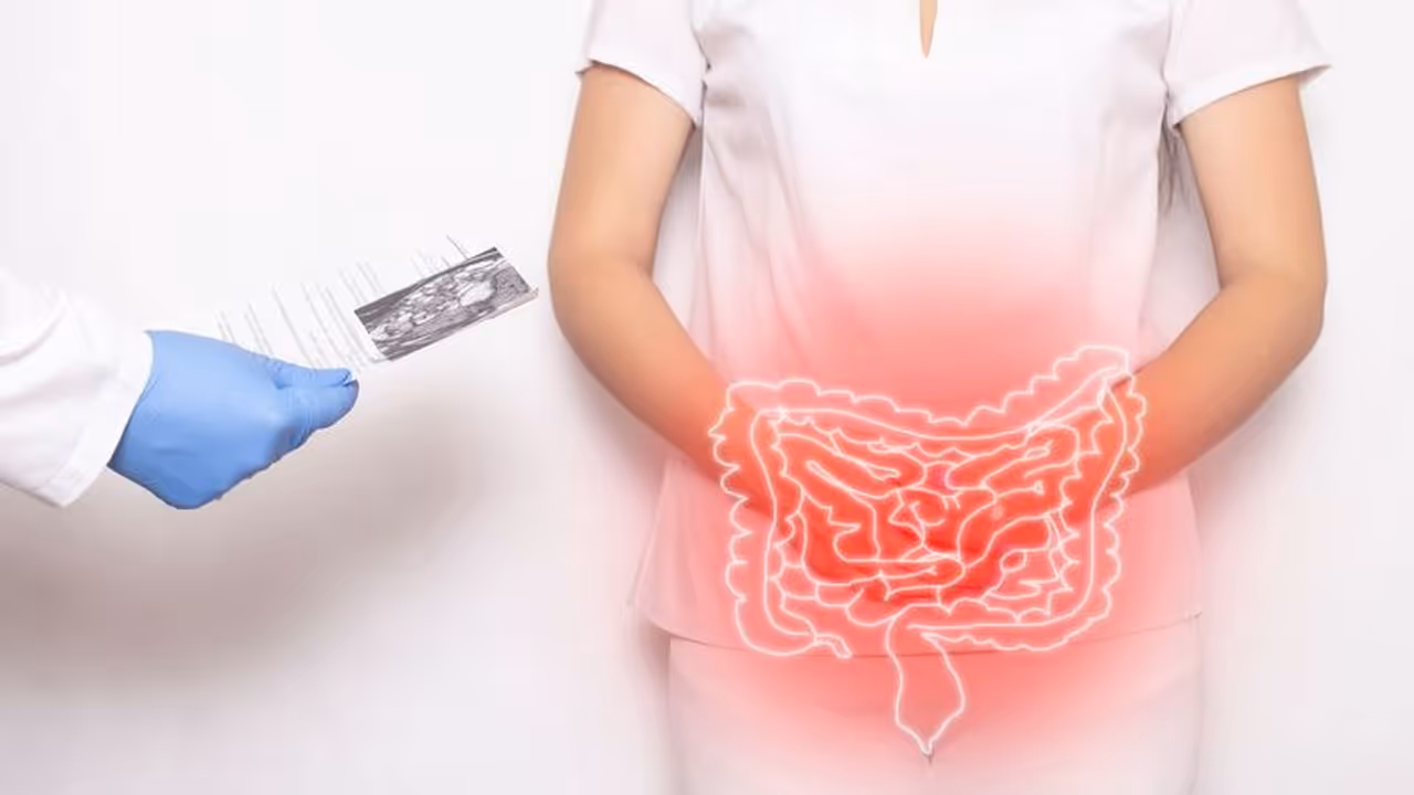 കുടൽ ക്യാൻസർ ബാധിതരുടെ എണ്ണത്തിൽ വർദ്ധന ; കാരണങ്ങൾ ഇവ