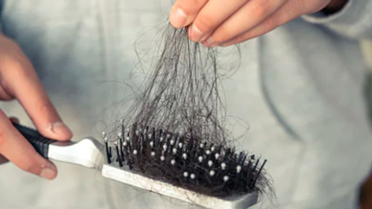 குளிர்காலத்தில் முடி கொத்து கொத்தா கொட்டுதா? தடுக்க சூப்பரான டிப்ஸ் இதோ..!! குளிர்காலத்தில் முடி கொத்து கொத்தா கொட்டுதா? தடுக்க சூப்பரான டிப்ஸ் இதோ..!!