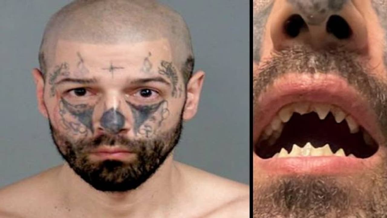 ബോഡി മോഡിഫിക്കേഷനിലൂടെ 'രാക്ഷസ'രൂപമായി, ഗർഭിണിയായ യുവതിയെ ബന്ദിയാക്കി പീഡിപ്പിച്ച യുവാവ് അറസ്റ്റിൽ