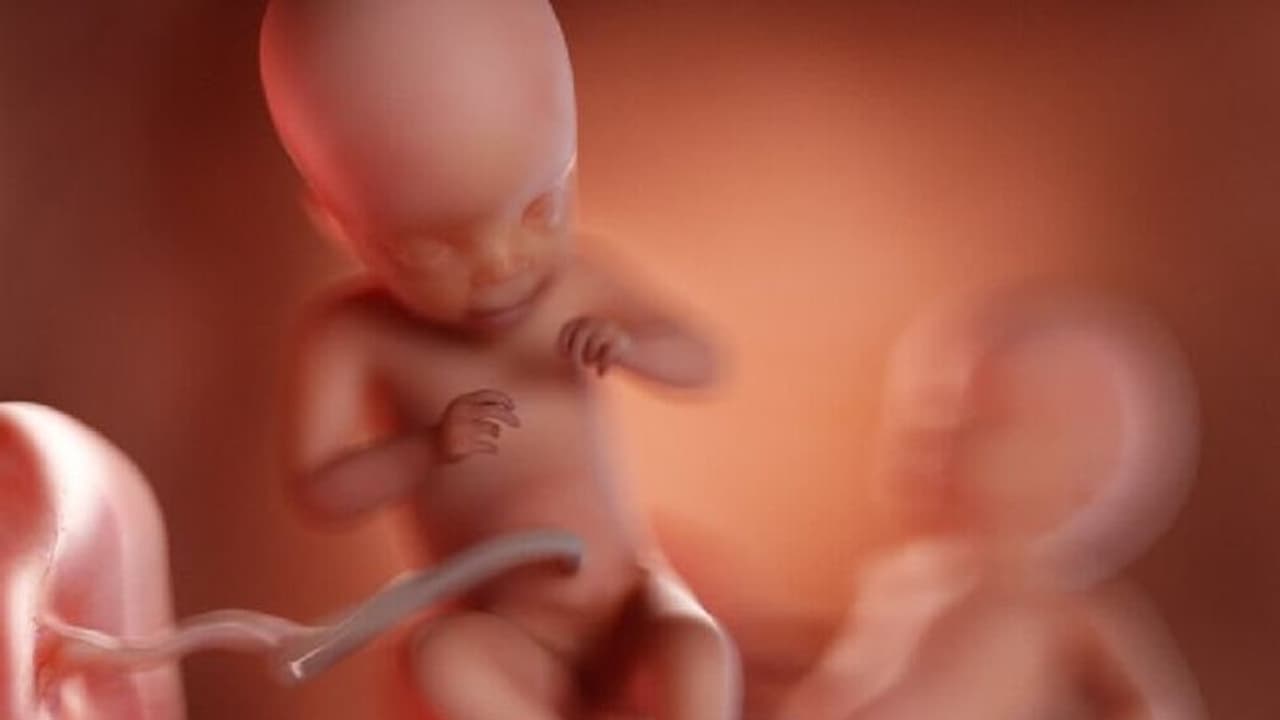 ആലപ്പുഴയിലെ ഇരട്ടകളുടെ മരണം; 'ട്വിൻ ടു ട്വിൻ ട്രാൻസ്ഫ്യൂഷൻ സിൻഡ്രോം' എന്താണെന്നറിയാം...