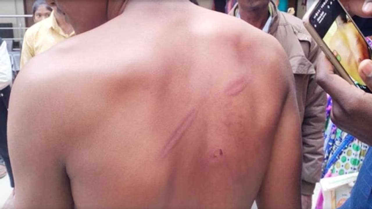 एक दिन स्कूल न आने पर बच्चे की बेरहमी से पिटाई, आरोपी शिक्षक के खिलाफ कार्रवाई की मांग को लेकर हंगामा एक दिन स्कूल न आने पर बच्चे की बेरहमी से पिटाई, आरोपी शिक्षक के खिलाफ कार्रवाई की मांग को लेकर हंगामा