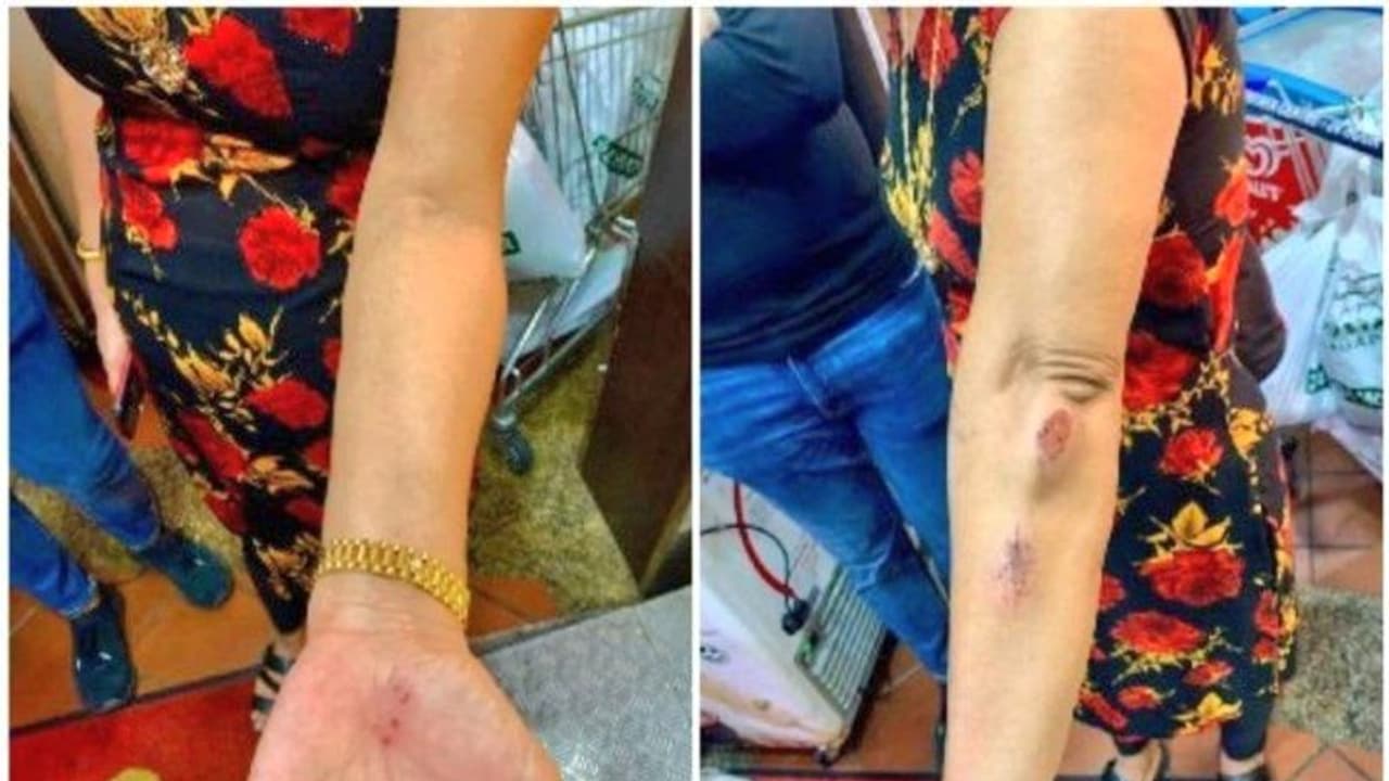 महिला ने ठोड़ी तक सरका रखा था मास्क, युवक ने गुस्से में छाती पर दे मारी लात, सुर्खियों में 2 साल पुराना केस महिला ने ठोड़ी तक सरका रखा था मास्क, युवक ने गुस्से में छाती पर दे मारी लात, सुर्खियों में 2 साल पुराना केस