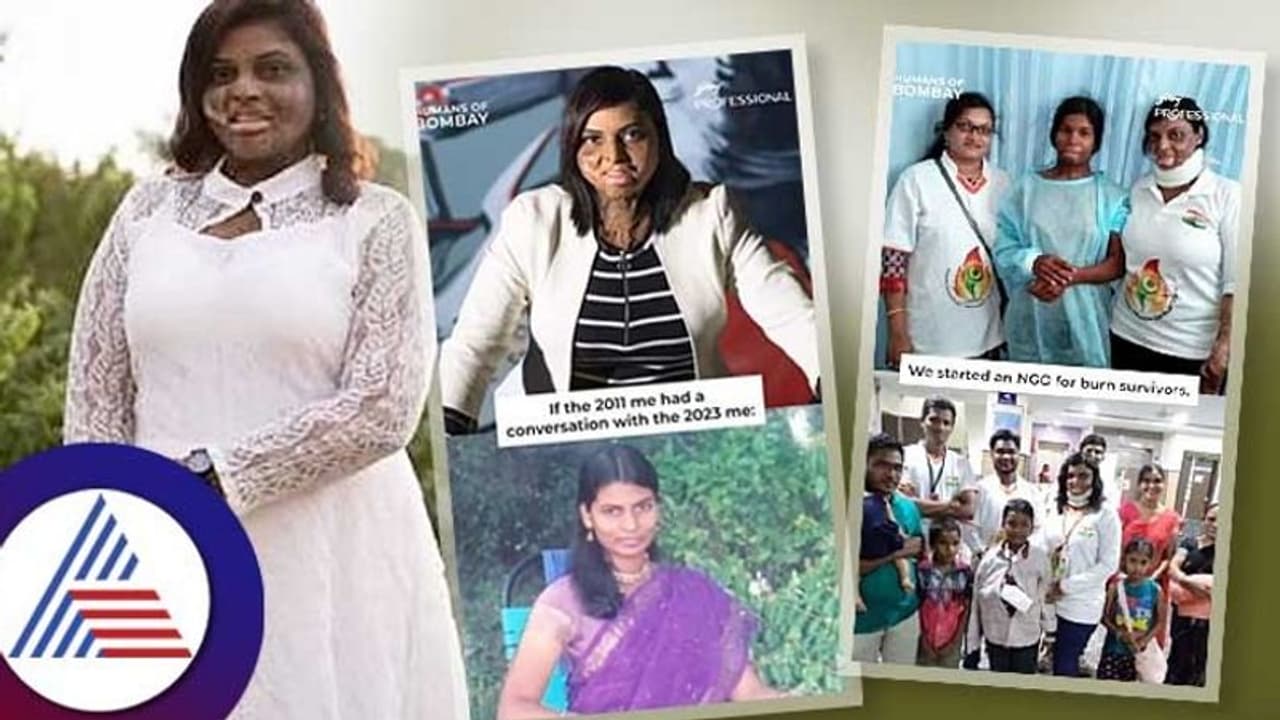 ಗಂಡನ ಸೆಕ್ಸ್ ಕಾಟಕ್ಕೆ ನೊಂದು ಬೆಂಕಿ ಹಚ್ಚಿಕೊಂಡು, ಬೆಂದು ಬಂದಳು..!