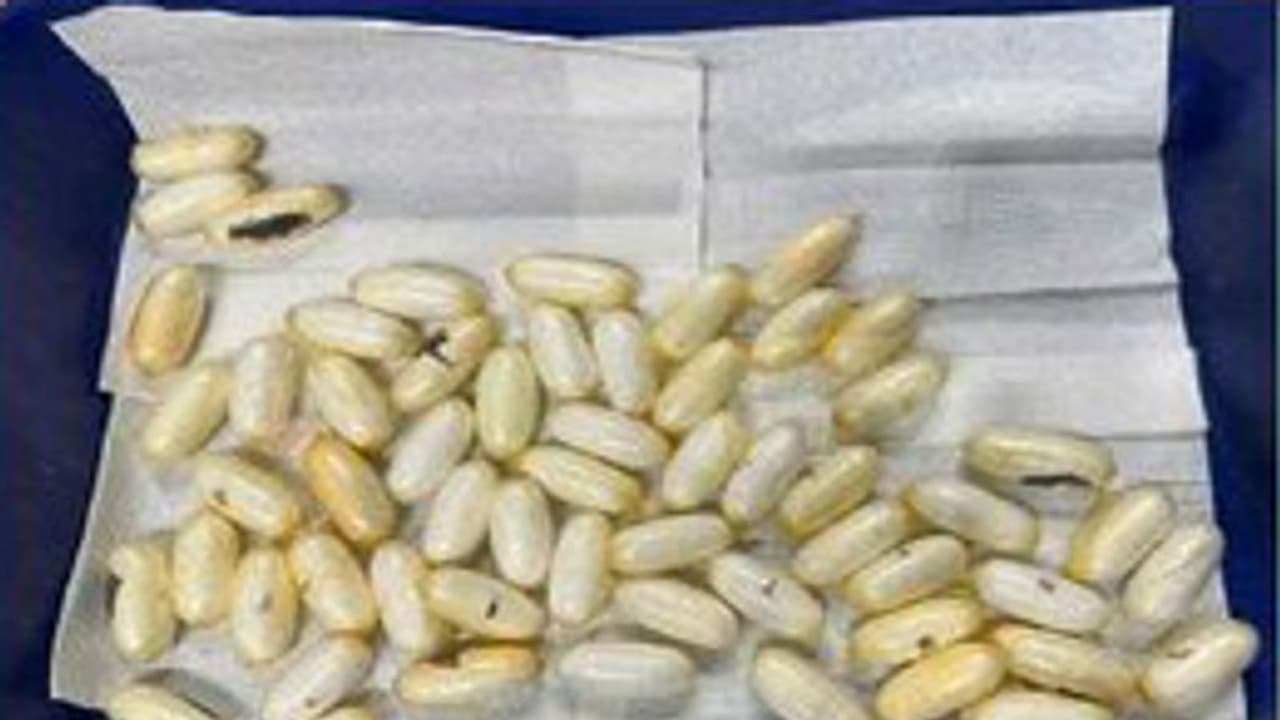 Bengaluru crime: ಮಾತ್ರೆ ರೂಪದಲ್ಲಿ ವ್ಯಕ್ತಿಯ ಹೊಟ್ಟೆಯಲ್ಲಿತ್ತು ಕೊಕೇನ್! Bengaluru crime: ಮಾತ್ರೆ ರೂಪದಲ್ಲಿ ವ್ಯಕ್ತಿಯ ಹೊಟ್ಟೆಯಲ್ಲಿತ್ತು ಕೊಕೇನ್!