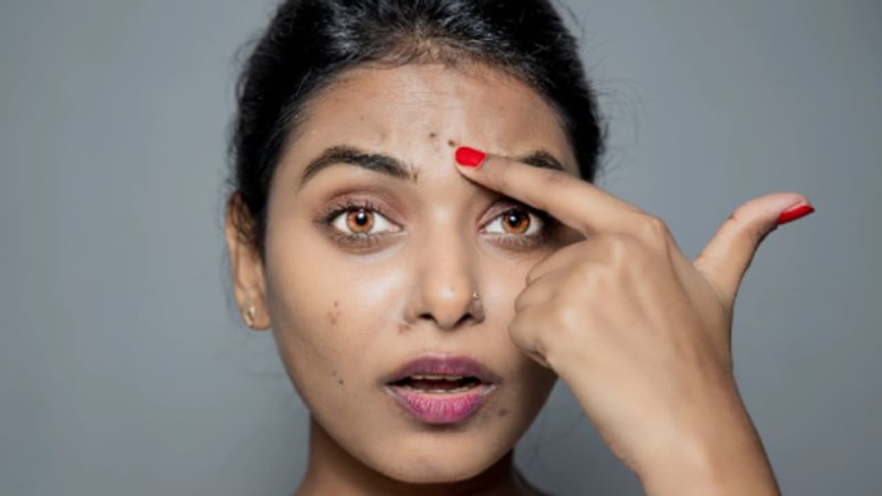 ముఖంపై నల్లని మచ్చలు ఇబ్బంది పెడుతున్నాయా? ఇలా చేస్తే తొందరగా పోతయ్ ముఖంపై నల్లని మచ్చలు ఇబ్బంది పెడుతున్నాయా? ఇలా చేస్తే తొందరగా పోతయ్