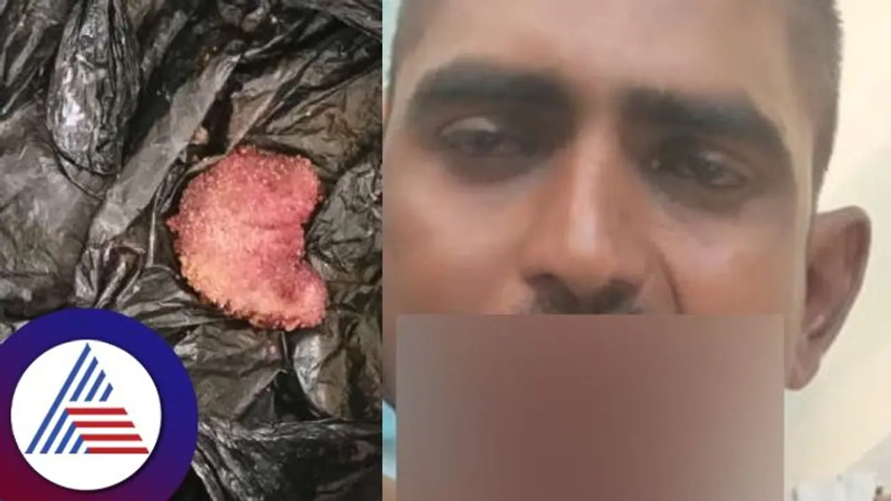 ಕನಸಲ್ಲಿ ದೇವರು ಹೇಳಿದ್ದಕ್ಕೆ ನಾಲಗೆ ಕತ್ತರಿಸಿಕೊಂಡ ಬಳ್ಳಾರಿ ಯುವಕ! 