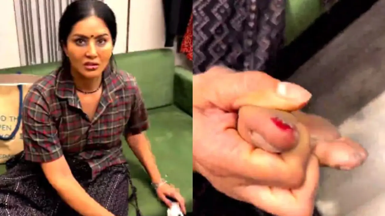 Video: Sunny Leone gets hurt, shares video of her bleeding toe on Instagram WATCH