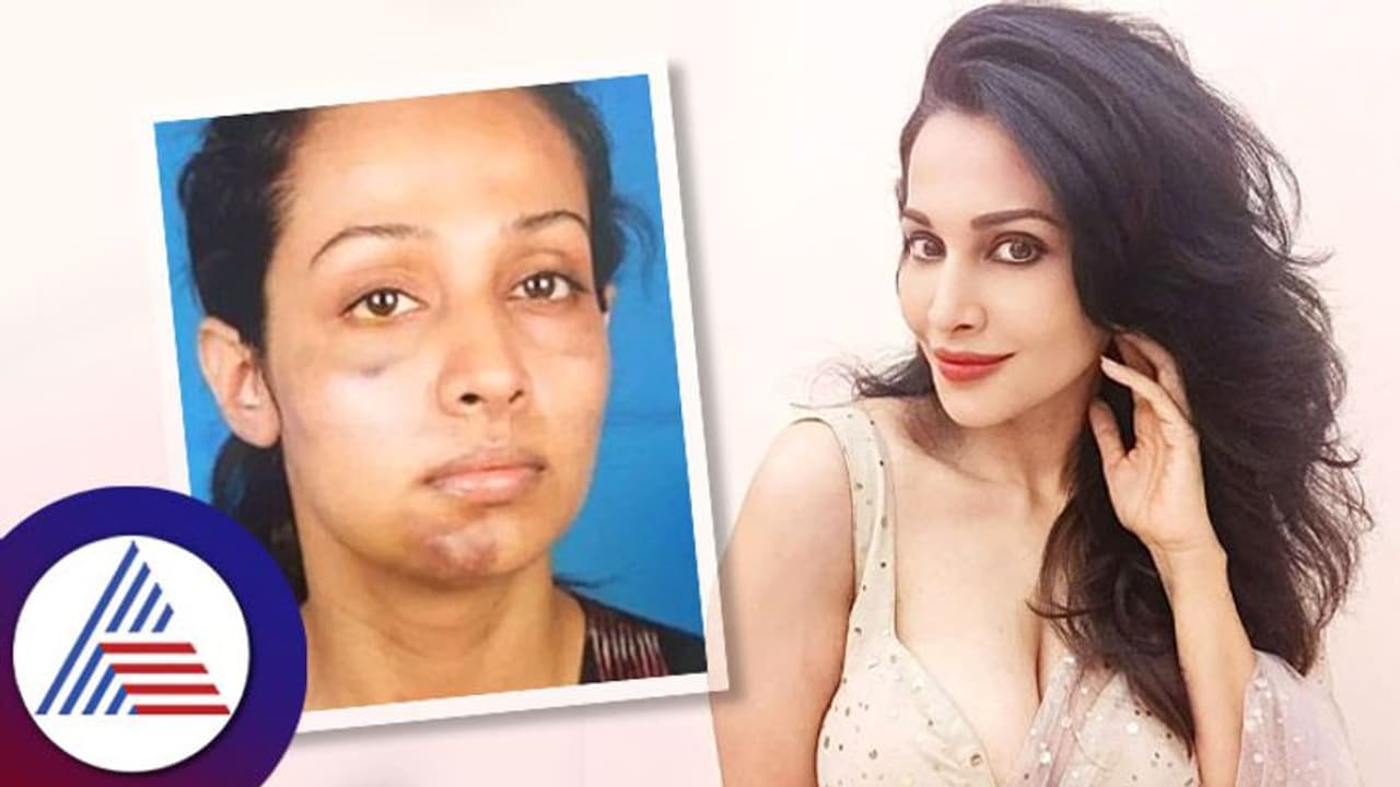 ಖಾಸಗಿ ಭಾಗಕ್ಕೆ ಹೊಡೆಯುತ್ತಿದ್ದ: ನಿರ್ಮಾಪಕನ ಕರಾಳ ಕೃತ್ಯ ಬಿಚ್ಚಿಟ್ಟ Flora Saini ಖಾಸಗಿ ಭಾಗಕ್ಕೆ ಹೊಡೆಯುತ್ತಿದ್ದ: ನಿರ್ಮಾಪಕನ ಕರಾಳ ಕೃತ್ಯ ಬಿಚ್ಚಿಟ್ಟ Flora Saini