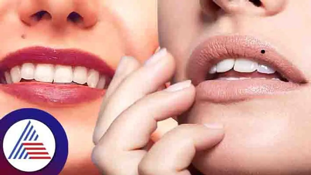 ದೇಹದ ಈ 7 ಭಾಗಗಳಲ್ಲಿ ಮಚ್ಚೆ ಇದ್ದಾಕೆಯೇ ಅದೃಷ್ಟವಂತೆ!