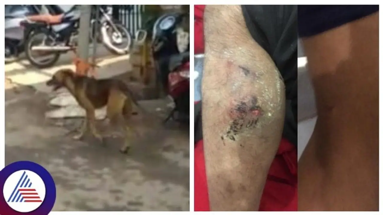 ಬೆಳಗಾವಿ ಜನರ ನಿದ್ದೆಗೆಡಿಸಿದ ಏಕೈಕ ಬೀದಿ ನಾಯಿ, ಮಹಾನಗರ ಪಾಲಿಕೆ ವಿರುದ್ಧ ಜನರ ಅಸಮಾಧಾನ! ಬೆಳಗಾವಿ ಜನರ ನಿದ್ದೆಗೆಡಿಸಿದ ಏಕೈಕ ಬೀದಿ ನಾಯಿ, ಮಹಾನಗರ ಪಾಲಿಕೆ ವಿರುದ್ಧ ಜನರ ಅಸಮಾಧಾನ!