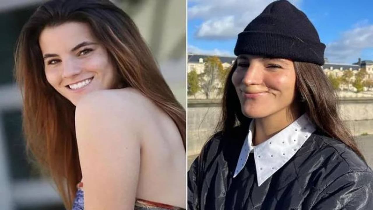 മോഡലിനെ കടിച്ചുകീറി പിറ്റ്‍ബുൾ, മേൽച്ചുണ്ട് പൂർണമായും നഷ്ടമായി, കടന്നുപോയത് ആറ് സർജറികളിലൂടെ