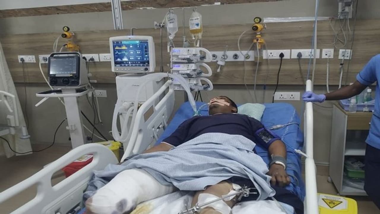 ಕಲಬುರಗಿ: ಪಿಎಸ್ಐ ಫೈರಿಂಗ್ ಪ್ರಕರಣ, ಆರೋಪಿ ಕಾಲು ಕತ್ತರಿಸಿದ ವೈದ್ಯರು ಕಲಬುರಗಿ: ಪಿಎಸ್ಐ ಫೈರಿಂಗ್ ಪ್ರಕರಣ, ಆರೋಪಿ ಕಾಲು ಕತ್ತರಿಸಿದ ವೈದ್ಯರು