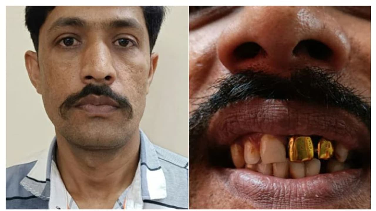 സ്വർണപ്പല്ല് ചതിച്ചു, 15 വർഷമായി പൊലീസിനെ വെട്ടിച്ച് ഒളിവിൽ കഴിഞ്ഞയാൾ പിടിയിൽ 