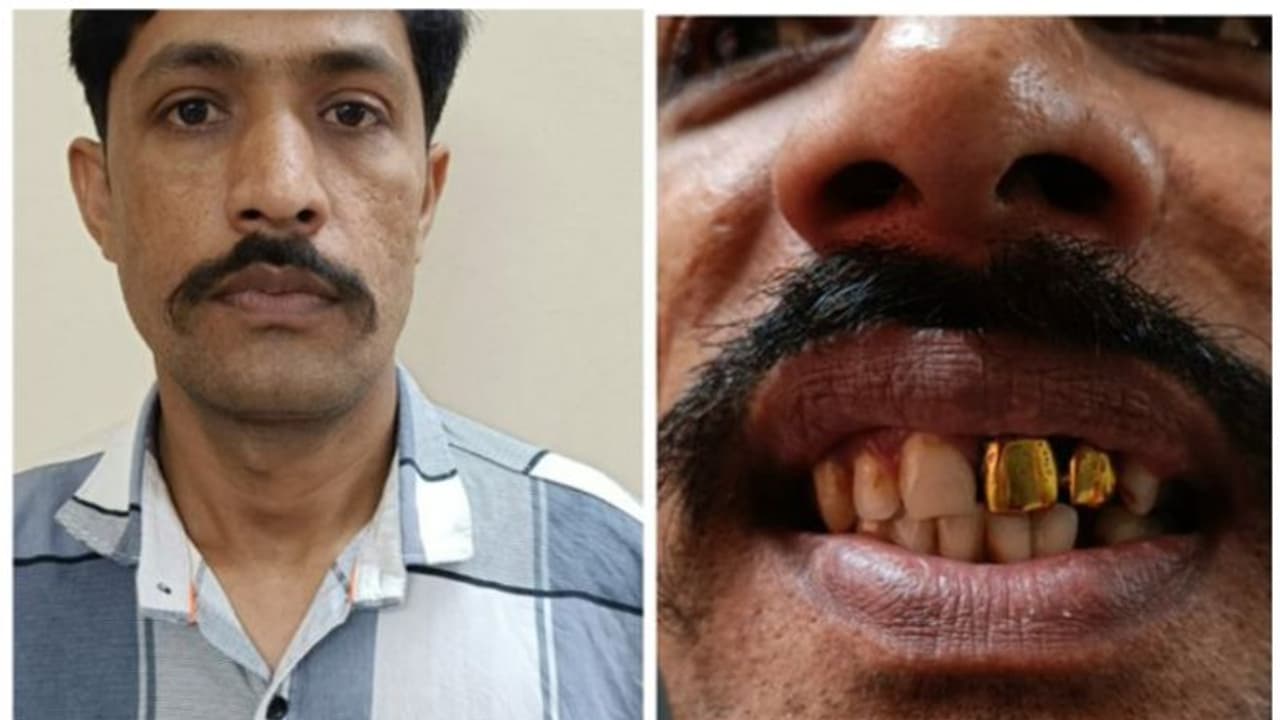 സ്വർണപ്പല്ല് 'കെണി'യായി; 15 വർഷത്തിനു ശേഷം പിടികിട്ടാപ്പുള്ളി പിടിയിൽ സ്വർണപ്പല്ല് 'കെണി'യായി; 15 വർഷത്തിനു ശേഷം പിടികിട്ടാപ്പുള്ളി പിടിയിൽ