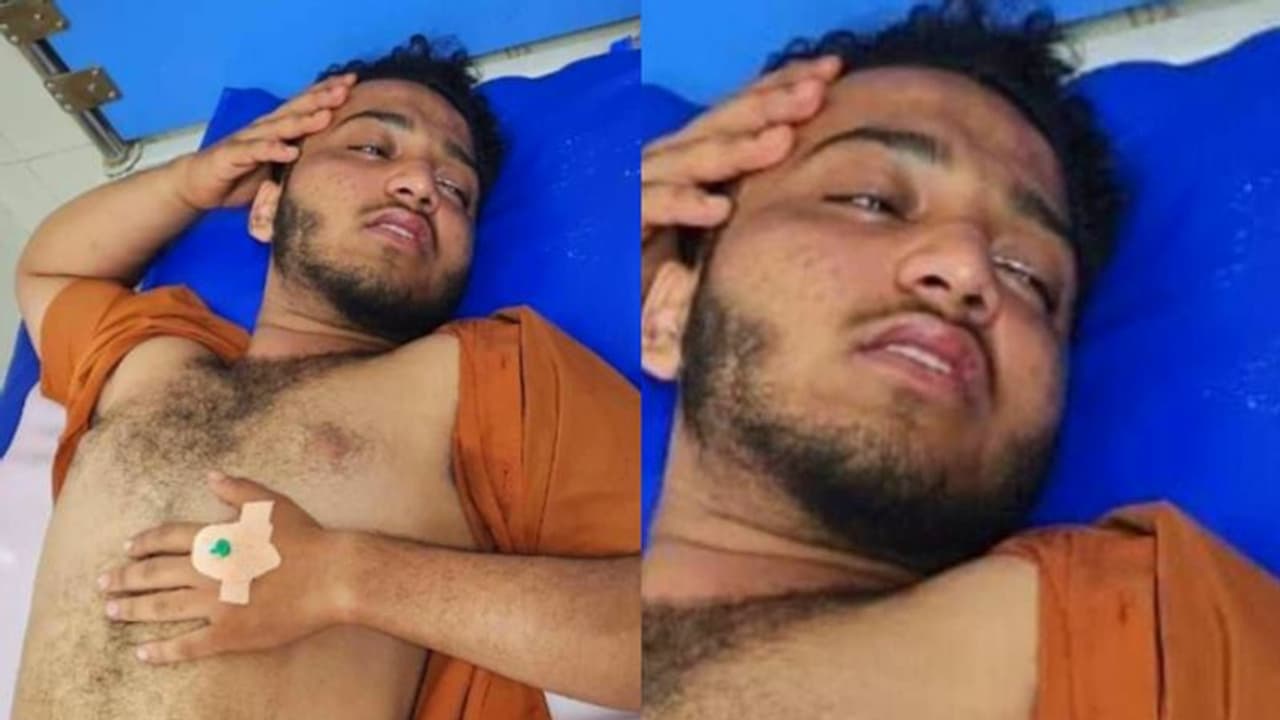 കൂളിംഗ് ഗ്ലാസ് വെച്ചത് ഇഷ്ടപ്പെട്ടില്ല; പോളിടെക്നിക്ക് വിദ്യാർത്ഥിക്ക് സീനിയേഴ്സിന്റെ ക്രൂരമർദ്ദനം, നടപടി കൂളിംഗ് ഗ്ലാസ് വെച്ചത് ഇഷ്ടപ്പെട്ടില്ല; പോളിടെക്നിക്ക് വിദ്യാർത്ഥിക്ക് സീനിയേഴ്സിന്റെ ക്രൂരമർദ്ദനം, നടപടി