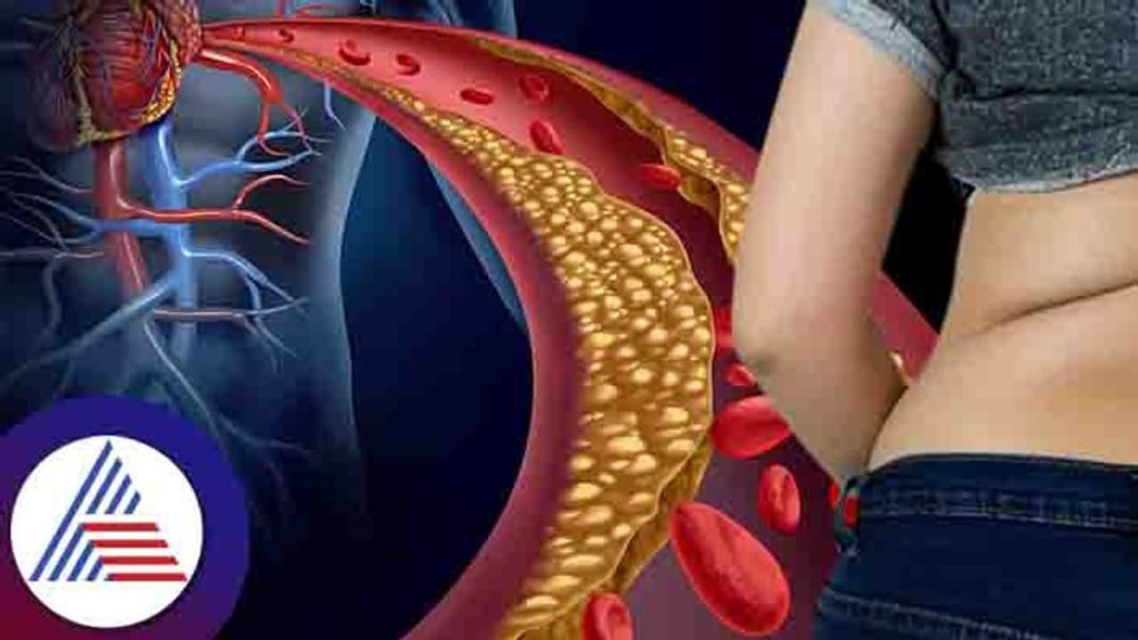 Cholesterol Problem: ಎಷ್ಟು ಯತ್ನಿಸಿದ್ರೂ ಕೊಬ್ಬು ಕಡಿಮೆಯಾಗ್ತಿಲ್ವಾ? ಇದಿರಬಹುದು ಕಾರಣ Cholesterol Problem: ಎಷ್ಟು ಯತ್ನಿಸಿದ್ರೂ ಕೊಬ್ಬು ಕಡಿಮೆಯಾಗ್ತಿಲ್ವಾ? ಇದಿರಬಹುದು ಕಾರಣ