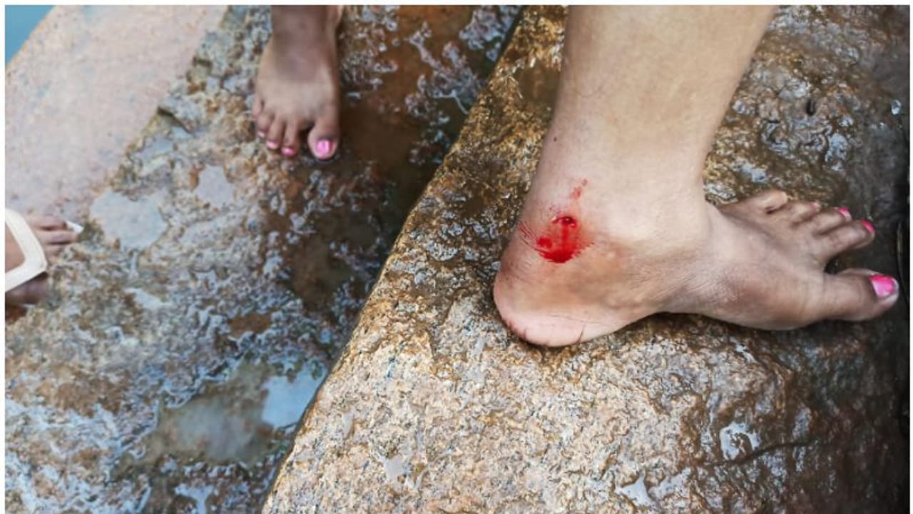 ആറ്റില് കുളിക്കുന്നതിനിടെ അപ്രതീക്ഷിത ആക്രമണം, നീര് നായയുടെ കടിയേറ്റ് നിരവധി പേർക്ക് പരിക്ക്, ഭയപ്പാടിൽ ജനം ആറ്റില് കുളിക്കുന്നതിനിടെ അപ്രതീക്ഷിത ആക്രമണം, നീര് നായയുടെ കടിയേറ്റ് നിരവധി പേർക്ക് പരിക്ക്, ഭയപ്പാടിൽ ജനം