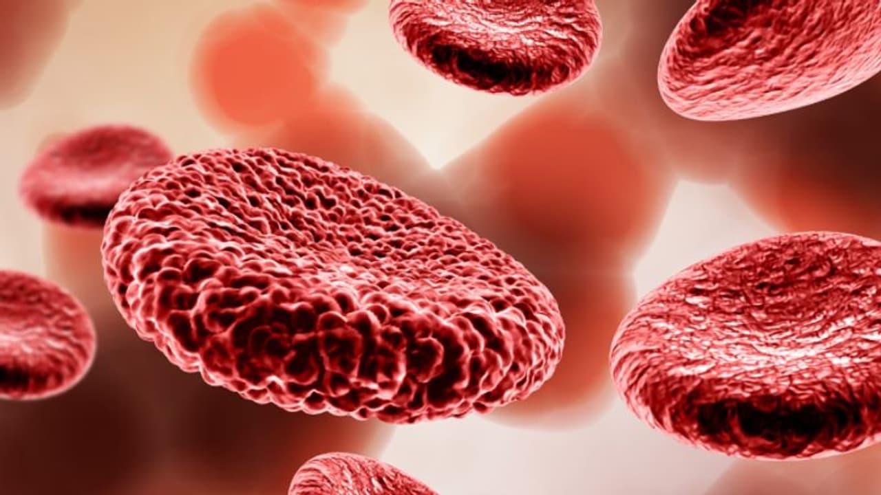 വിളര്‍ച്ചയെ തടയാന്‍ വീട്ടിലുള്ള ഈ ഭക്ഷണങ്ങള്‍ കഴിക്കാം...