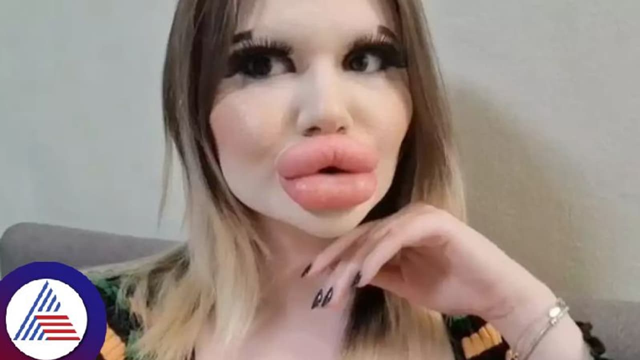 ವಿಶ್ವದ ಅತಿ ದೊಡ್ಡ ತುಟಿ ಹೊಂದಿರುವ ಮಹಿಳೆಯೀಕೆ, 34ಕ್ಕೂ ಹೆಚ್ಚು ಇಂಜೆಕ್ಷನ್ ಹಾಕಿಸಿಕೊಂಡಿದ್ದಾಳಂತೆ! ವಿಶ್ವದ ಅತಿ ದೊಡ್ಡ ತುಟಿ ಹೊಂದಿರುವ ಮಹಿಳೆಯೀಕೆ, 34ಕ್ಕೂ ಹೆಚ್ಚು ಇಂಜೆಕ್ಷನ್ ಹಾಕಿಸಿಕೊಂಡಿದ್ದಾಳಂತೆ!