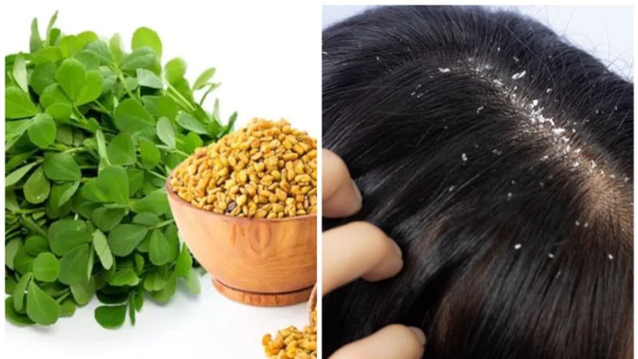 మెంతికూరతో చుండ్రు సమస్యకు చెక్.. ఇది మాత్రమే కాదు ఆ సమస్యలన్నీ మాయం! మెంతికూరతో చుండ్రు సమస్యకు చెక్.. ఇది మాత్రమే కాదు ఆ సమస్యలన్నీ మాయం!