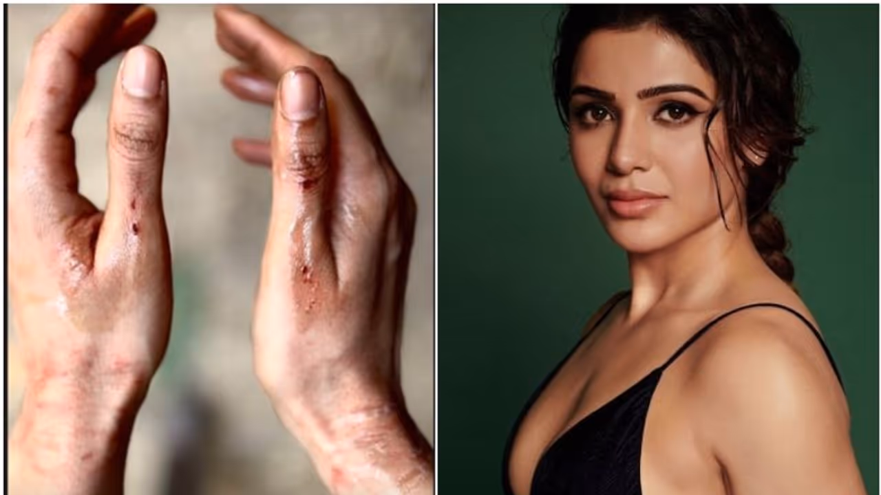 ಅಯ್ಯೋ..! ಮತ್ತೇ ಏನಾಯ್ತು; ರಕ್ತ ಸೋರುತ್ತಿರುವ ಸಮಂತಾ ಕೈ ನೋಡಿ ಫ್ಯಾನ್ಸ್ ಶಾಕ್ 