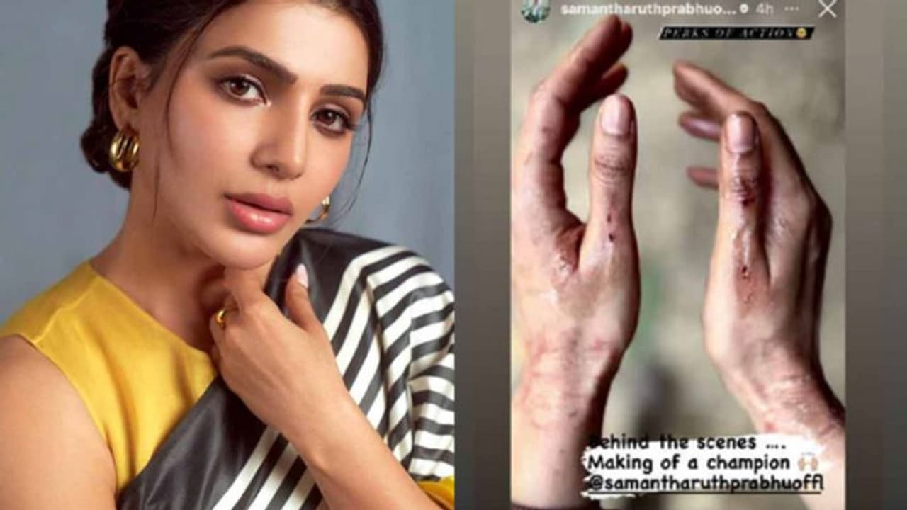 ഷൂട്ടിംഗിനിടയില് നടി സാമന്തയ്ക്ക് പരുക്കേറ്റു ഷൂട്ടിംഗിനിടയില് നടി സാമന്തയ്ക്ക് പരുക്കേറ്റു