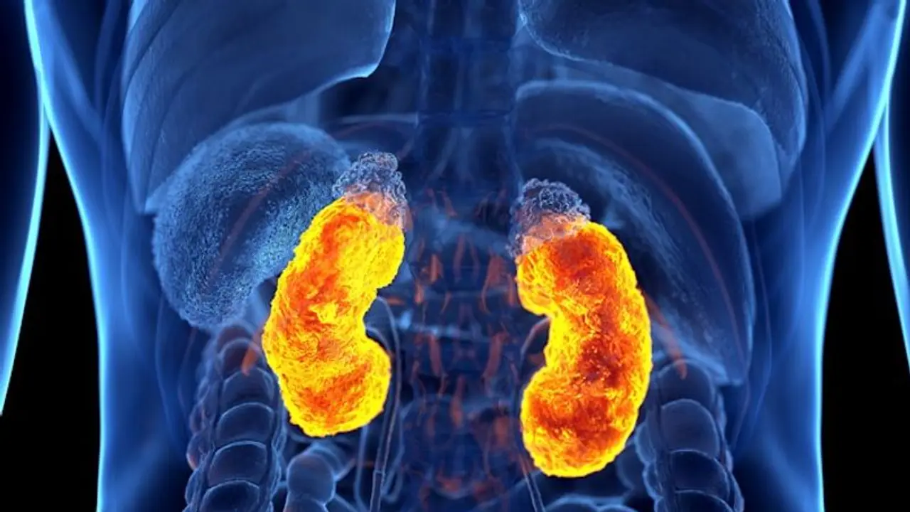 World Kidney Day 2023: 5 symptoms that indicate you may have a kidney disease