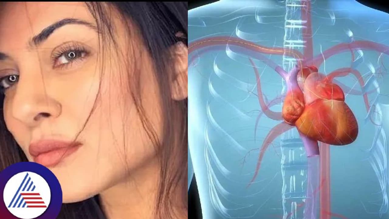 ಹಾರ್ಟ್ ಅಟ್ಯಾಕ್ ಆದ್ರೂ ಆಂಜಿಯೋಪ್ಲಾಸ್ಟಿ ಸರ್ಜರಿಯಿಂದ ಬದುಕುಳಿದ ಸುಶ್ಮಿತಾ ಸೇನ್, ಹಾಗಂದ್ರೇನು ? ಹಾರ್ಟ್ ಅಟ್ಯಾಕ್ ಆದ್ರೂ ಆಂಜಿಯೋಪ್ಲಾಸ್ಟಿ ಸರ್ಜರಿಯಿಂದ ಬದುಕುಳಿದ ಸುಶ್ಮಿತಾ ಸೇನ್, ಹಾಗಂದ್ರೇನು ?