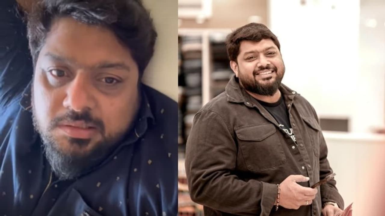 ബെല്‍സ് പാള്‍സി രോഗം; നടന്‍ മിഥുന്‍ രമേശ് ആശുപത്രിയില്‍