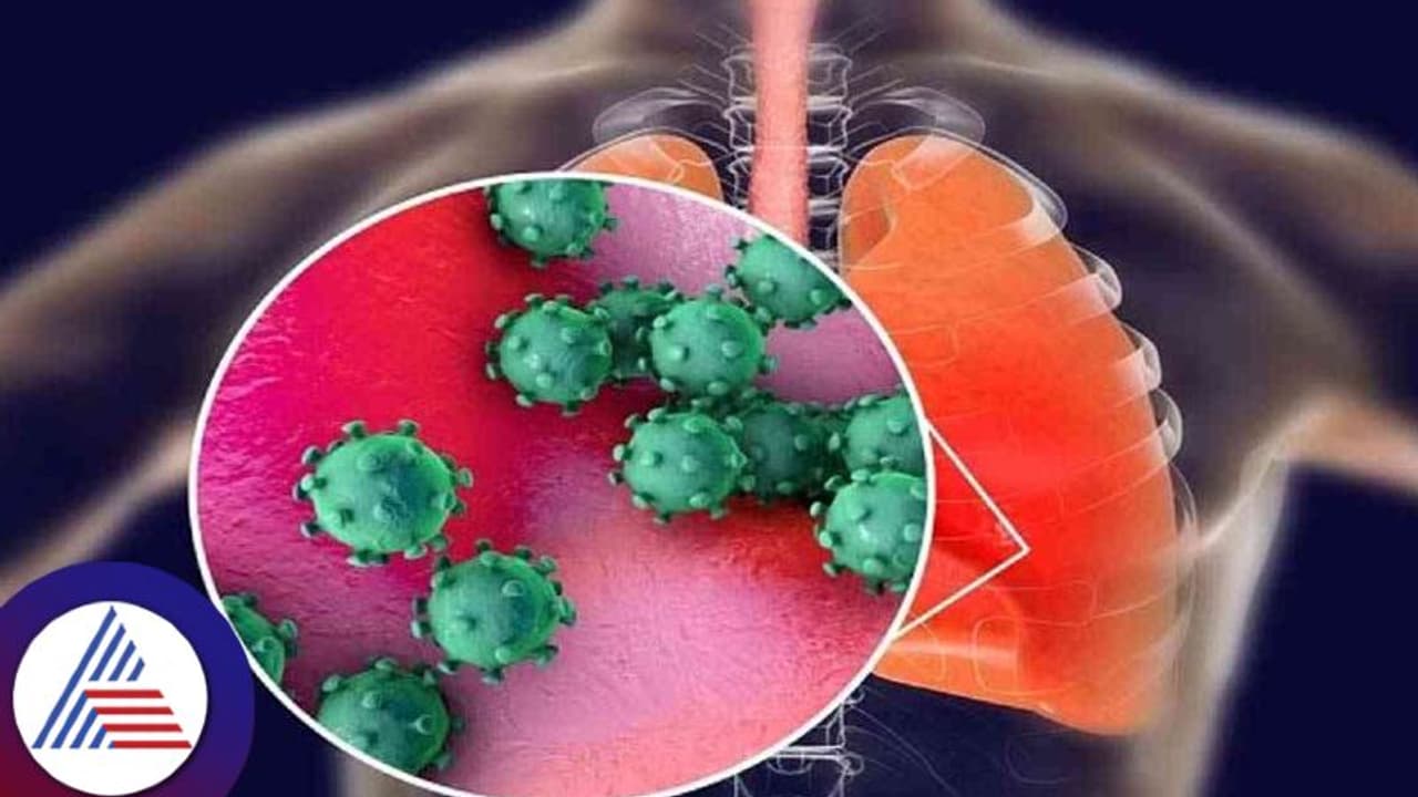 ದೇಶಾದ್ಯಂತ ವ್ಯಾಪಕ ಜ್ವರ, ಕೆಮ್ಮಿನ ಹಾವಳಿ, H3N2 ವೈರಸ್ ಕಾರಣ ಎಂದ ತಜ್ಞರು ದೇಶಾದ್ಯಂತ ವ್ಯಾಪಕ ಜ್ವರ, ಕೆಮ್ಮಿನ ಹಾವಳಿ, H3N2 ವೈರಸ್ ಕಾರಣ ಎಂದ ತಜ್ಞರು