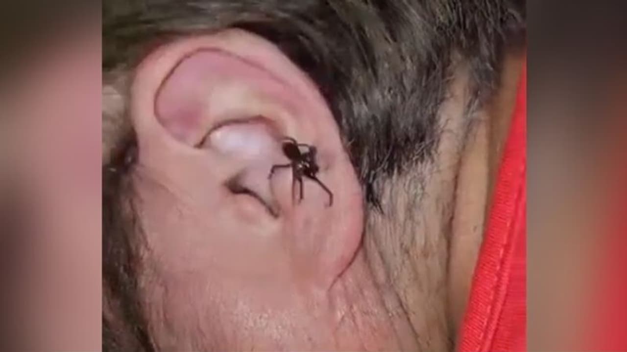 ചെവിയില് നിന്ന് എട്ടുകാലി ഇഴഞ്ഞ് പുറത്തേക്ക് വരുന്നു; വീഡിയോ വൈറലാകുന്നു... ചെവിയില് നിന്ന് എട്ടുകാലി ഇഴഞ്ഞ് പുറത്തേക്ക് വരുന്നു; വീഡിയോ വൈറലാകുന്നു...