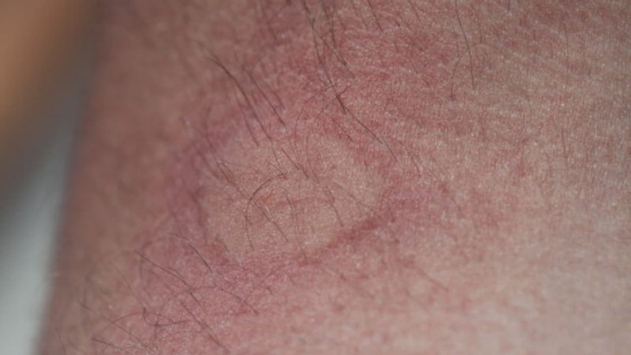 ഈച്ച പോലുള്ള പ്രാണി കുത്തി, തിരുവല്ലയില് 13കാരിക്ക് ദാരുണാന്ത്യം ഈച്ച പോലുള്ള പ്രാണി കുത്തി, തിരുവല്ലയില് 13കാരിക്ക് ദാരുണാന്ത്യം