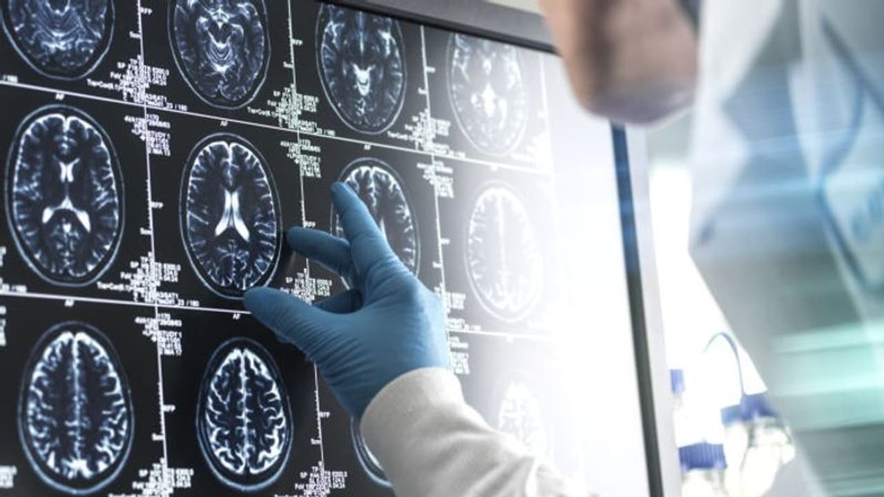 Over 10 million older adults in India likely have dementia: AI study