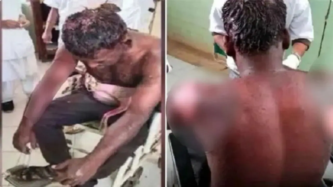 ಹೋಳಿ ಬಣ್ಣ ಹಚ್ಚಿದ್ದಕ್ಕೆ ಹಿಂದು ಸ್ನೇಹಿತನಿಗೆ ಬೆಂಕಿ ಇಟ್ಟ ಮುಸ್ಲಿಂ ವ್ಯಕ್ತಿ!