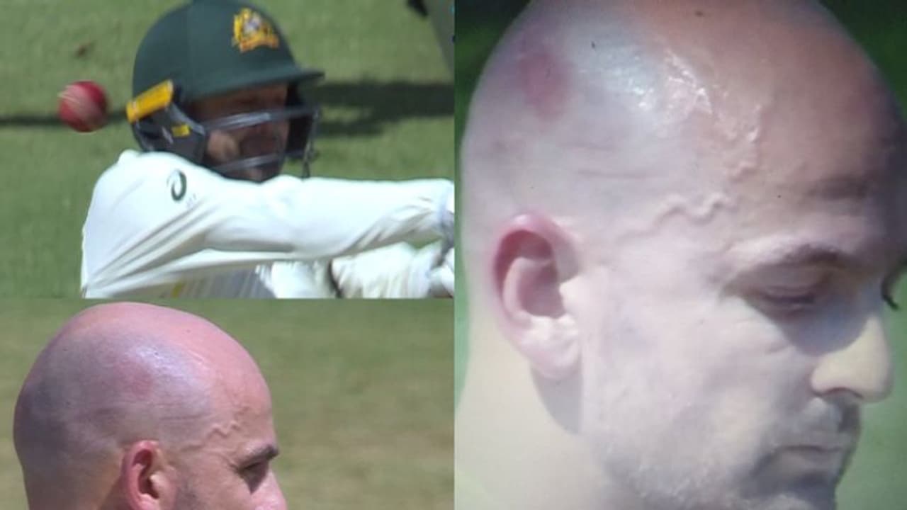 ഉമേഷ് യാദവിന്റെ മരണ ബൗണ്സർ, ഒഴിവായത് വന് ദുരന്തം; തലയില് പാട് വീണ് ലിയോണ്! ഉമേഷ് യാദവിന്റെ മരണ ബൗണ്സർ, ഒഴിവായത് വന് ദുരന്തം; തലയില് പാട് വീണ് ലിയോണ്!