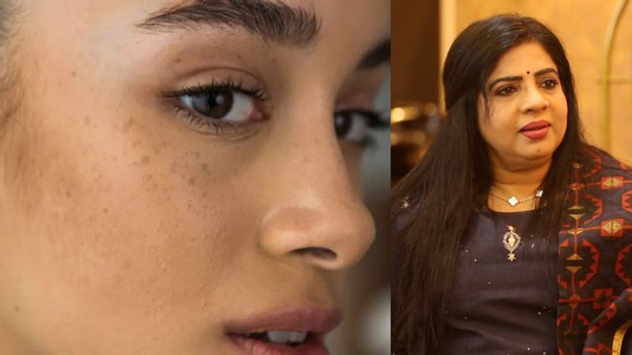 മുഖത്തെ കറുത്ത പാടുകള് മാറ്റാം ഈസിയായി; ടിപ്സ് പങ്കുവച്ച് അനില ജോസഫ്... മുഖത്തെ കറുത്ത പാടുകള് മാറ്റാം ഈസിയായി; ടിപ്സ് പങ്കുവച്ച് അനില ജോസഫ്...