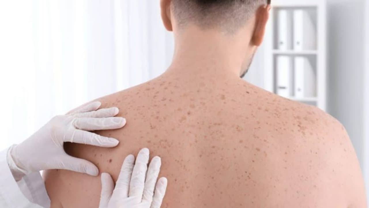 ചര്‍മ്മത്തില്‍ കാണുന്ന ഈ സൂചനകളെ നിസാരമായി കാണരുത്...