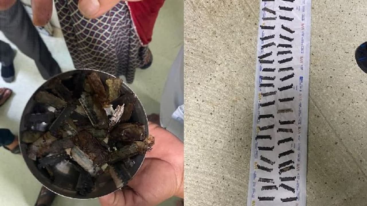  25 ವರ್ಷದ ಯುವಕನ ಹೊಟ್ಟೆಯಿಂದ 56 ಬ್ಲೇಡ್‌ ತುಂಡು ತೆಗೆದ ವೈದ್ಯರು