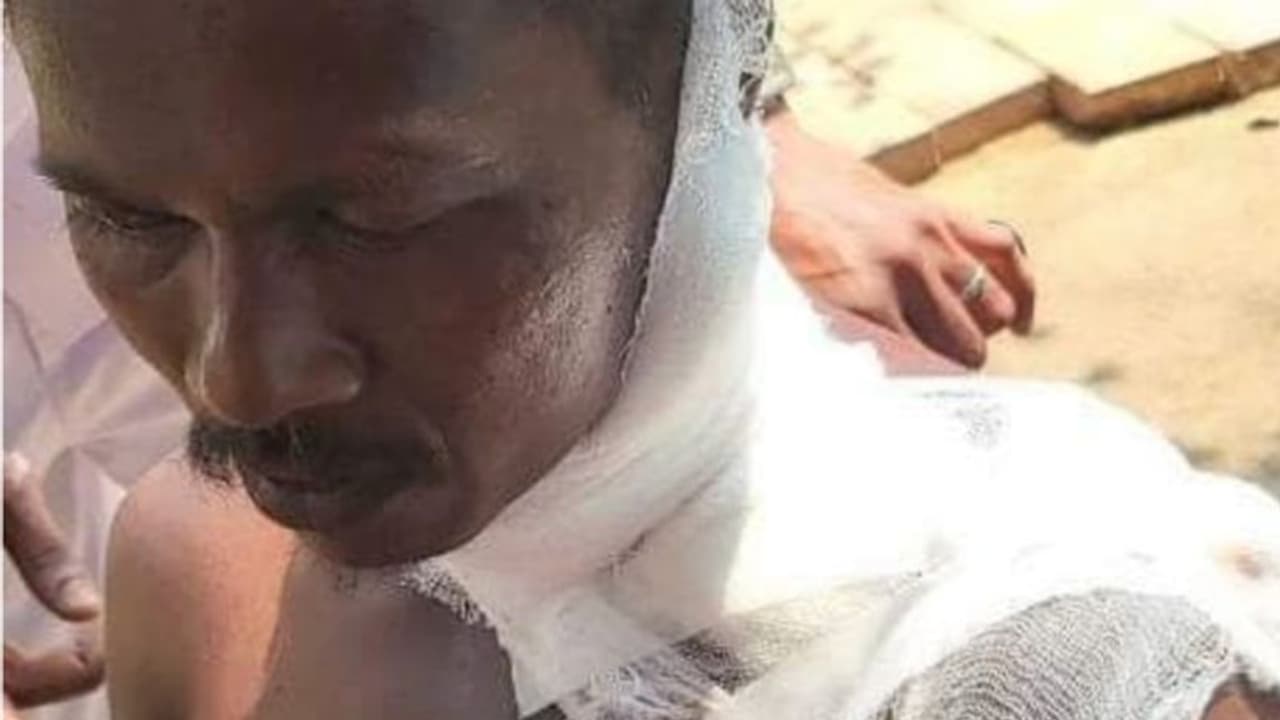 തേൻ തേടി ഭാര്യക്കൊപ്പം കാടുകയറിയ യുവാവിനെ കരടി ആക്രമിച്ചു, ഗുരുതര പരിക്ക്