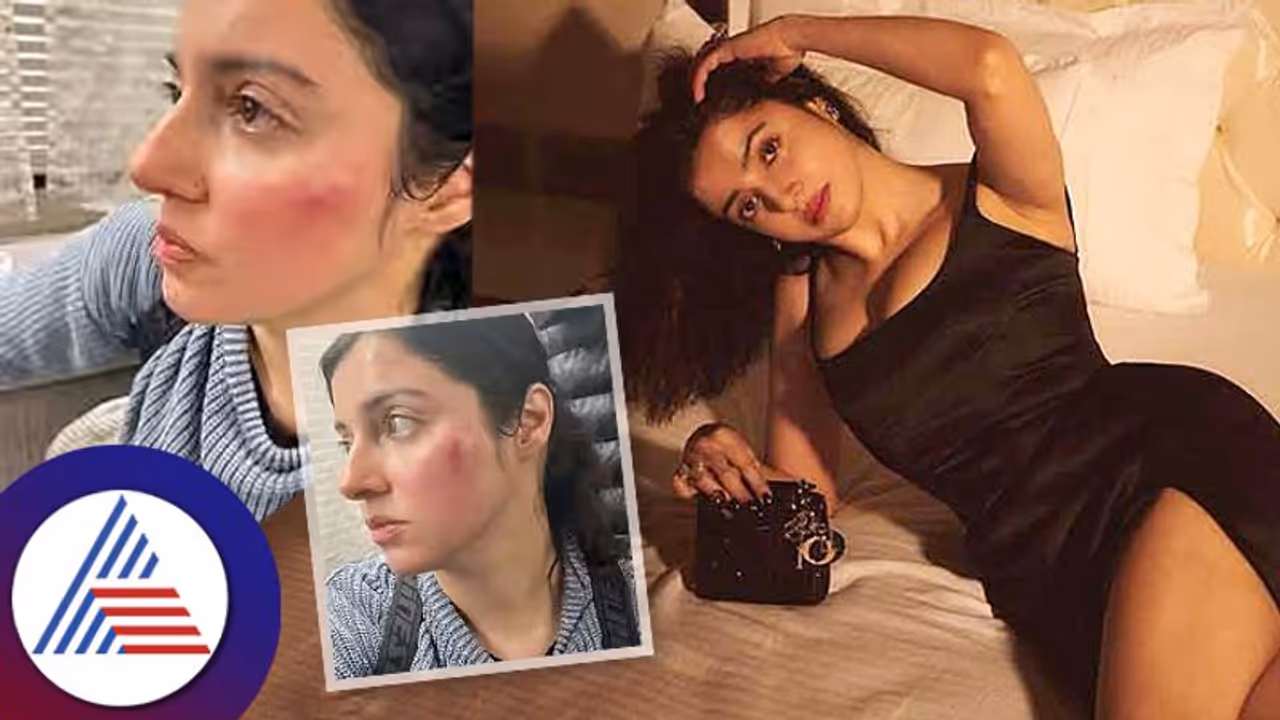 Divya Khosla Kumar: ಶೂಟಿಂಗ್ ವೇಳೆ ಅವಘಡ ಬಾಲಿವುಡ್ ನಟಿಗೆ ಗಾಯ Divya Khosla Kumar: ಶೂಟಿಂಗ್ ವೇಳೆ ಅವಘಡ ಬಾಲಿವುಡ್ ನಟಿಗೆ ಗಾಯ