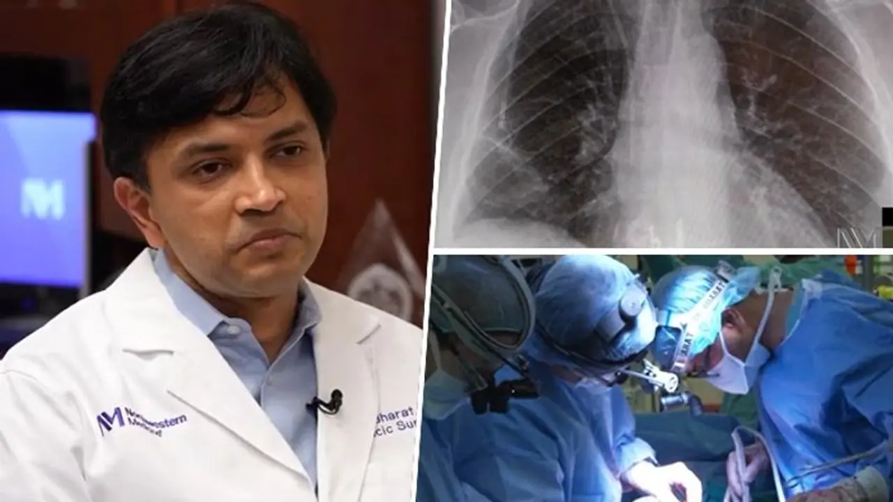 Miracle! How 'Bharat' helped woman become 2nd person to be CURED of terminal stage 4 lung cancer