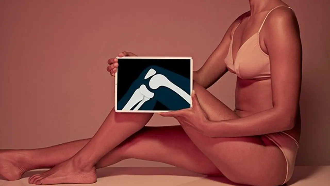 Bone health in females: Factors that impact women's health and avoid osteoporosis Bone health in females: Factors that impact women's health and avoid osteoporosis