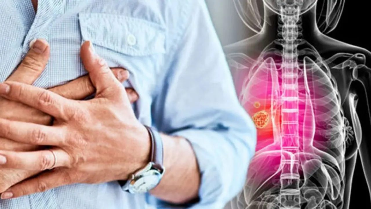 Unveiling hidden dangers   8 surprising risk factors for Lung Cancer you should be aware of