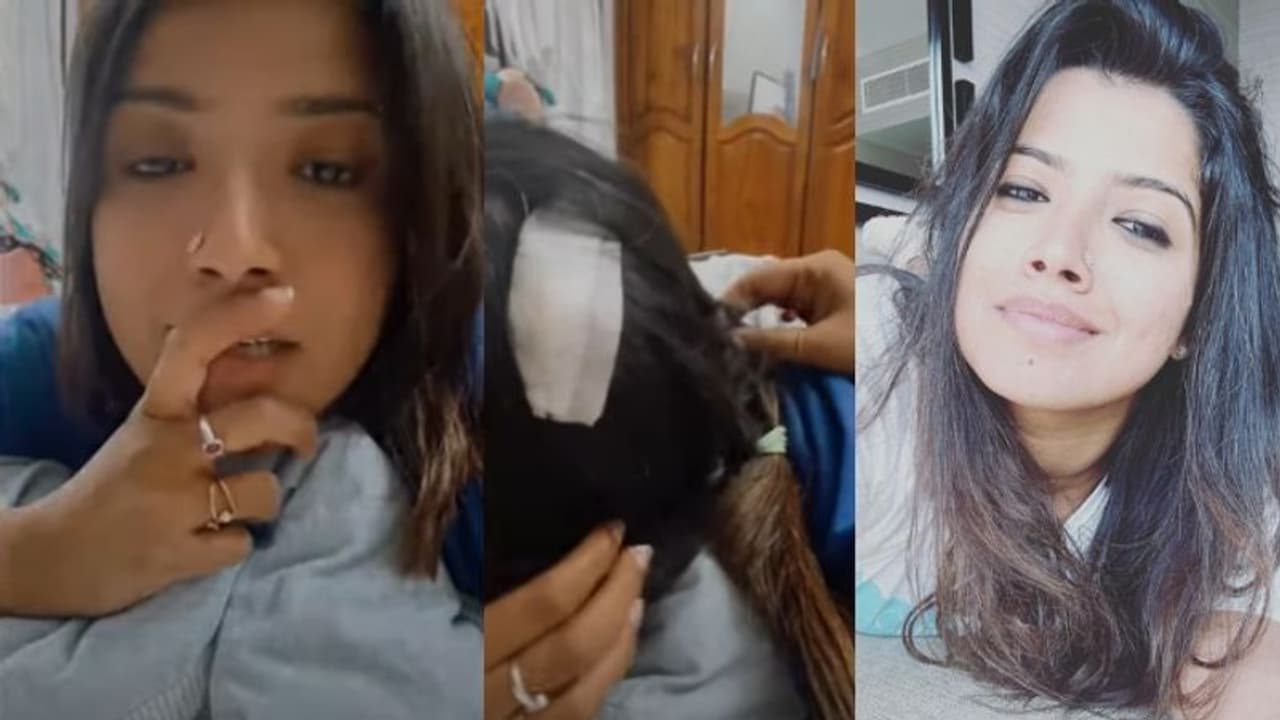 'രണ്ട് സ്റ്റിച്ചുണ്ട്, നല്ല വേദനയാണ്'; അമൃത സുരേഷിന്റെ തലയ്ക്ക് പരിക്ക്