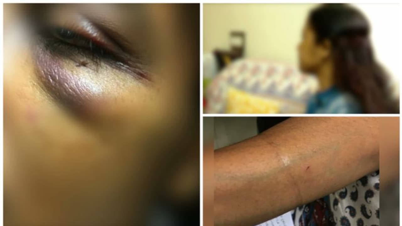 തിരുവനന്തപുരത്ത് നടുറോഡിൽ ലൈംഗികാതിക്രമം, വിവരം അറിയിച്ചിട്ടും അനങ്ങാതെ പൊലീസ്, കേസെടുത്തത് 3 ദിവസത്തിന് ശേഷം തിരുവനന്തപുരത്ത് നടുറോഡിൽ ലൈംഗികാതിക്രമം, വിവരം അറിയിച്ചിട്ടും അനങ്ങാതെ പൊലീസ്, കേസെടുത്തത് 3 ദിവസത്തിന് ശേഷം