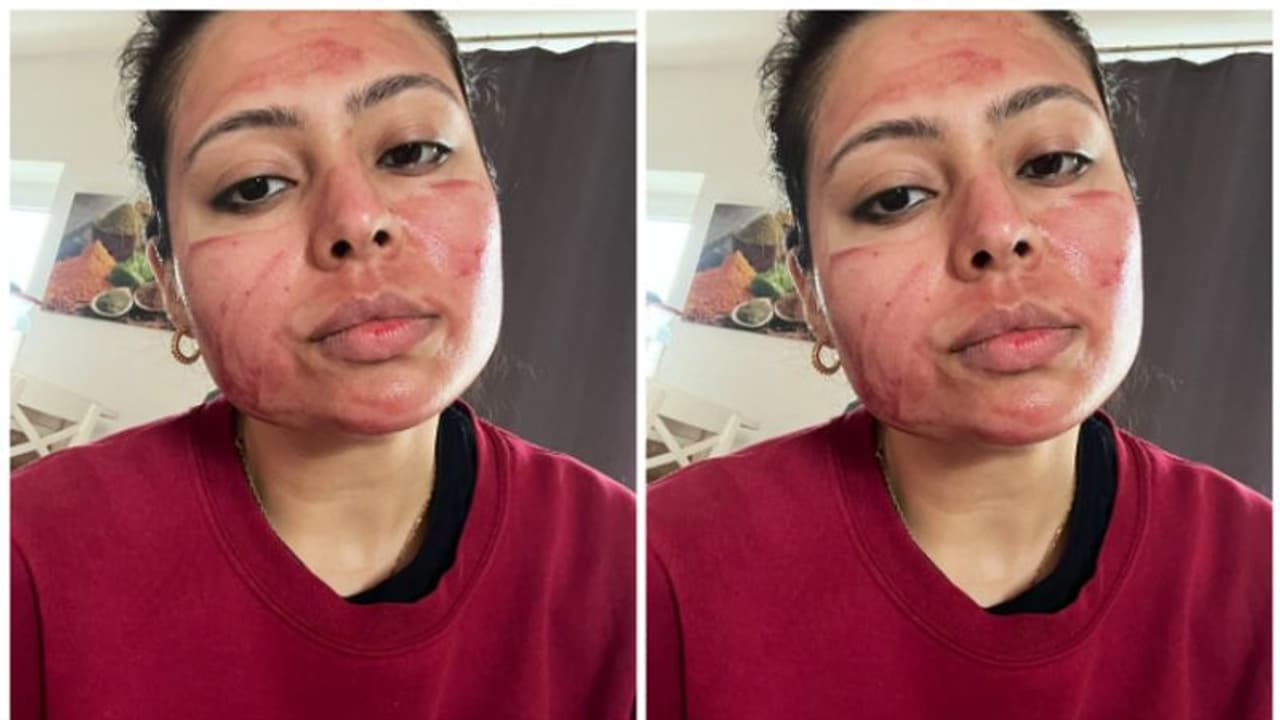 ചര്മ്മ സംരക്ഷണത്തിന് രക്തം; ട്വിറ്ററില് വൈറലായി ഒരു തമാശ കുറിപ്പ് ചര്മ്മ സംരക്ഷണത്തിന് രക്തം; ട്വിറ്ററില് വൈറലായി ഒരു തമാശ കുറിപ്പ്