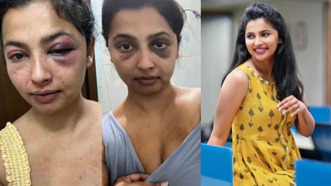 'പണത്തിനും പ്രശസ്‍തിക്കും വേണ്ടിയുള്ള വ്യാജ ആരോപണം'; നടി അനിഖ വിക്രമനെതിരെ മുന്‍ കാമുകന്‍ അനൂപ് പിള്ള