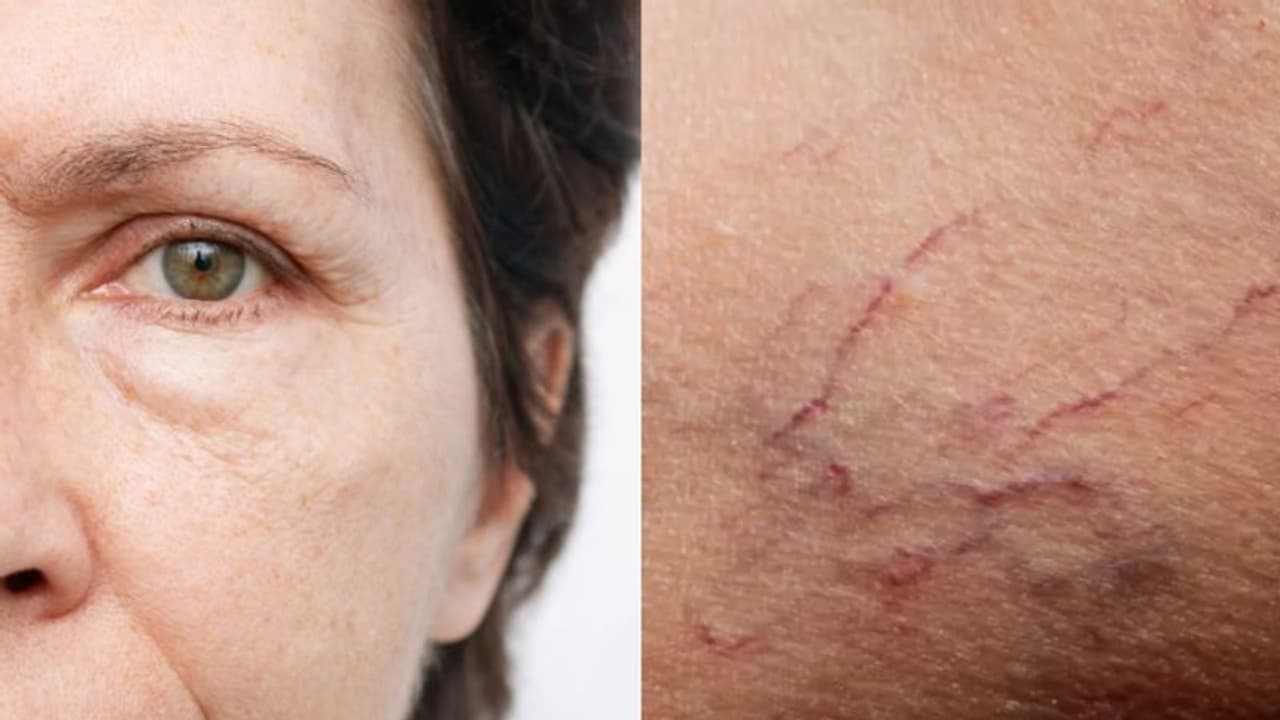 മുഖത്തും കണ്ണിലും ഈ ലക്ഷണങ്ങള്‍ കാണുന്നുവെങ്കില്‍ ശ്രദ്ധിക്കൂ; ഞരമ്പ് പിടച്ചിരിക്കുന്നതും നിസാരമാക്കല്ലേ...