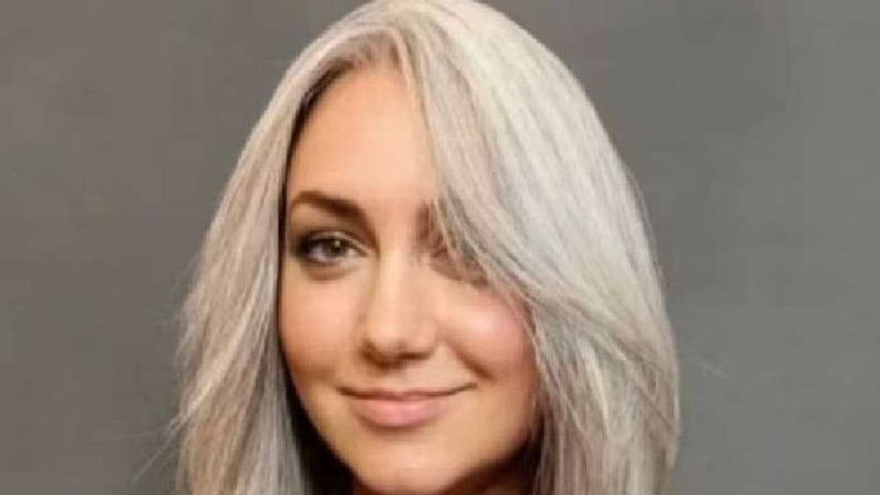 പത്തു വയസ്സുള്ളപ്പോൾ മുതൽ മുത്തശ്ശി എന്ന വിളി കേൾക്കേണ്ടിവന്ന യുവതി, പരിഹാസത്തിന് പിന്നിലെ കാരണം...